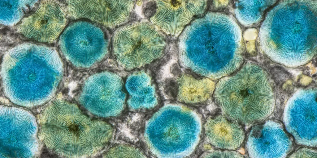 Cortisol under a microscope
